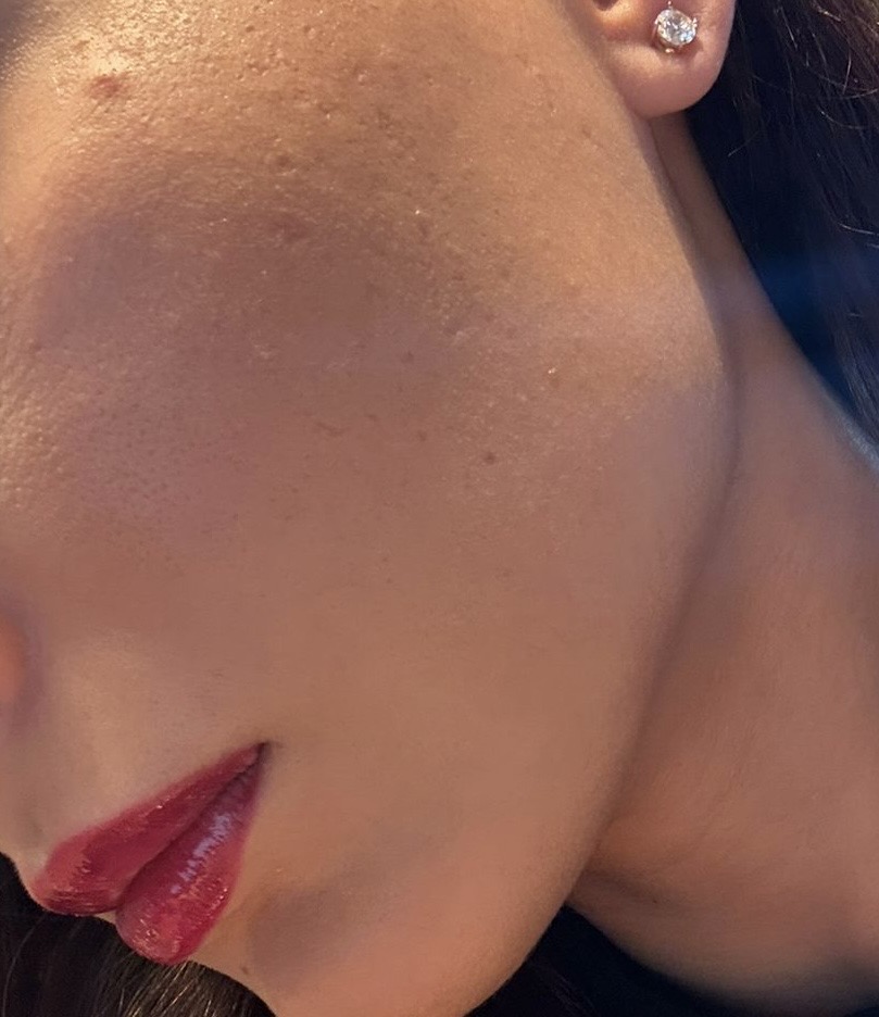 Alina after transformation