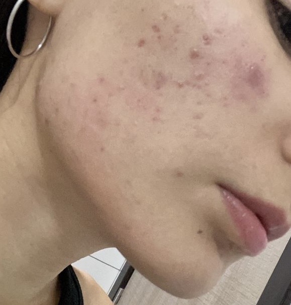 Alina before transformation